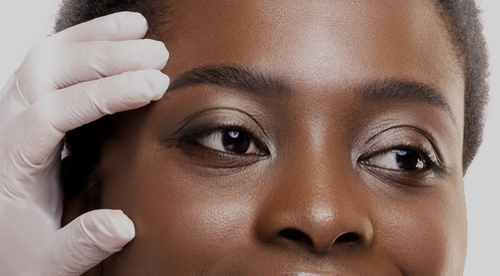 Can Hormone Replacement Lower Glaucoma Risk?