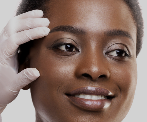 hormones and glaucoma hormones and glaucoma