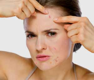 adult womens acne treatment adult womens acne treatment